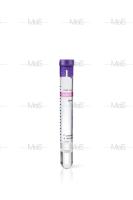 Quality Adjustable Centrifugal SST Blood Test Tube For PRP Separation for sale