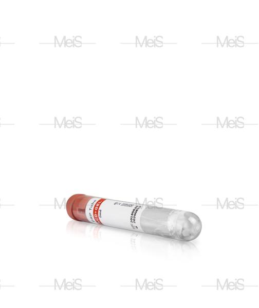 Quality Serum Separation SST Blood Test Tube PRP Vacutainer ODM for sale