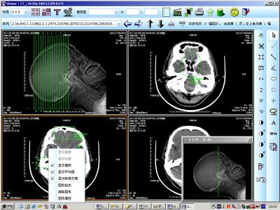 China 8 imagem latente diagnóstica médica do laser X Ray do papel de x 10inch para KND-DRYTEC 4000 à venda