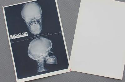 China Agudeza alta impermeável do filme de papel médico branco da caixa X Ray à venda