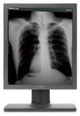 China 4096 Gray scale Medical Grade Displays G51SP Has five million pixels for sale