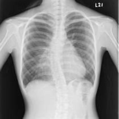 China Filmes médicos baixos brancos Wearable de X Ray, filme do papel do raio X da imagem latente médica à venda