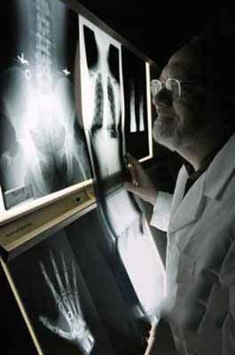China Diagnosetrockener Film lasers X Ray medizinisch für AGFA-/Fuji-Drucker zu verkaufen