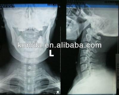 China Imagem latente diagnóstica médica da agudeza alta, filme seco de AGFA X Ray à venda