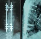 Китай двойник фильма рентгеновского снимка 8 кс 10 дюймов медицинский сухой встал на сторону для АГФА Дрыстар \ продается