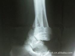 China Imagem latente médica Branca 8in x 10in do laser X Ray do Livro impermeável à venda