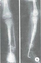 中国 防水乾燥した医学X光線はAGFA/富士のために光沢のあるKonidaを撮影します 販売のため