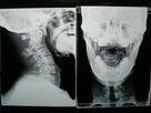 China Radiografía seca médica de Digitaces de la película de la proyección de imagen de Konida para las impresoras de Fuji/de Agfa en venta
