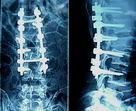 China Películas médicas de X Ray de la alta agudeza en venta