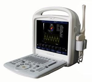 China Portable Completo-digital do sistema do ultrassom de Doppler da cor 15inch com software 3D/4D à venda
