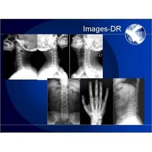 Chine Machine de radiographie de Digital de RAYON X de Mammogrpahy avec le bras flexible d'UC à vendre