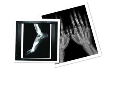 China Blanco médico de la película del CT de la pulgada ×10 de la prenda impermeable 8 del papel de X Ray de la película del ANIMAL DOMÉSTICO de Hosipital en venta