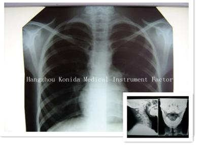 China Da imagem latente seca médica da saúde do filme 14 x 17inch de X Ray de Digitas filme radiográfico à venda