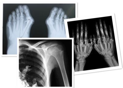 중국 방사선 사진술 검사를 위해 의학 열 디지털 방식으로 엑스레이 영화 Fuji 판매용