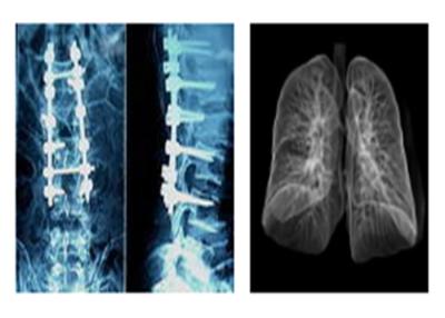 Chine Films médicaux radiographiques pointus de X Ray, film de Dr. Ct Digital Dry Imaging de Mri à vendre