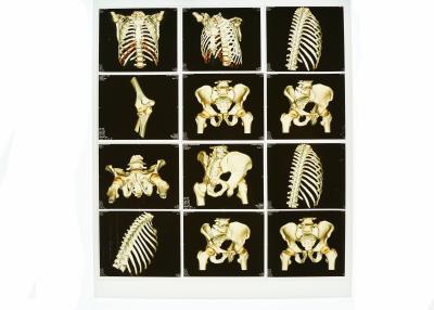 China Proyección de imagen de diagnóstico blanca usable de la base X Ray, película azul médica de X Ray del laser en venta