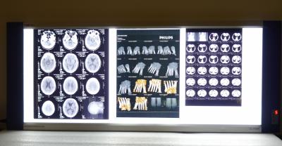 Chine films secs d'imagerie médicale de rayon X de 10in * de 14in Digital pour les imprimantes thermiques KND-F à vendre