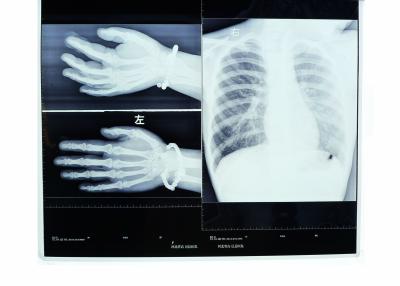 中国 Konidaの医学の乾燥したフィルム高リゾリューション熱抵抗イメージ投射 販売のため
