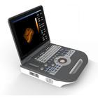 China Medical 4D Color Doppler Ultrasound Equipment Digital Portable Ultrasonography for sale