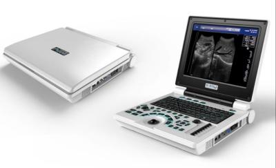China Laptop USG Machine Portable Ultrasound Equipment USS Scanner for sale