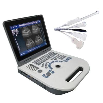 China ISO Portable Fetal Ultrasound Machine OB GYN for sale