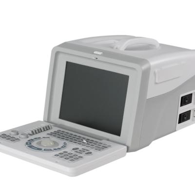 中国 XianfengのGynecologyのドップラー手持ち型の超音波のSonography機械装置の耐久財 販売のため