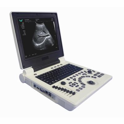 China Máquina portátil do ultrassom de Doppler da cor de OB GYN na gravidez à venda