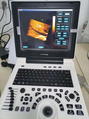 China Xianfeng Pregnancy Color Doppler Ultrasound Machines Images 4B OEM for sale