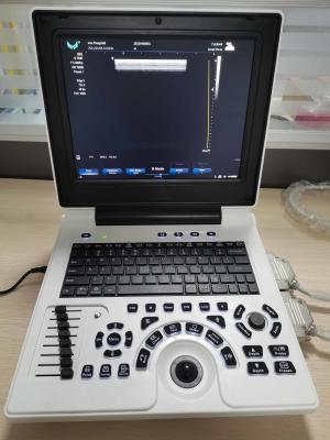 China BW PW High End Portable USG Machine Notebook Real Time Scan ODM for sale