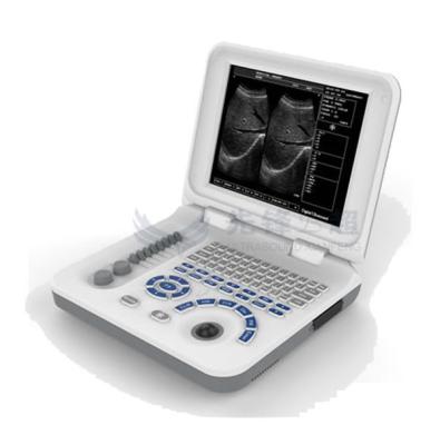 China OEM ODM Portable Ultrasound Machines For Home Use for sale