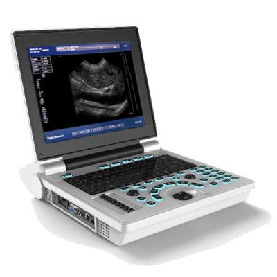 China 12 Inch BB USG Laptop Ultrasound Machines Scanner mobile Li Battery for sale