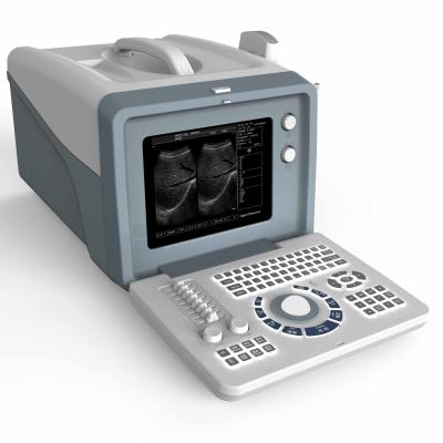China O ultrassom portátil do FSC 3D 4D MSK faz à máquina o transporte Vigianl da varredura à venda