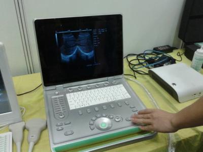 China Popular 3D Digital Laptop Veterinary Ultrasound Scanner Lightweight Easy To Carry for sale