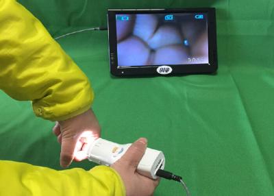 Chine X Colposcope électronique de Digital de 1,5 rapports optiques se relient à la TV ou l'ordinateur ou le moniteur médical santé de s pour femmes ' à vendre