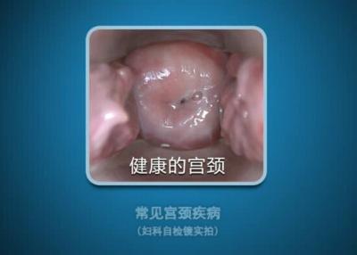 China Salida electrónica del Colposcope AV/USB de Digitaces del alto aparato ginecológico video de la definición en venta