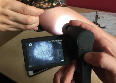 China Microscopio video Dermatoscope portátil de la piel con la exhibición rotativa del color TFT de 3 pulgadas en venta