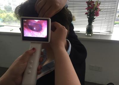 Китай Камера уха Отоскопе УСБ АВ цифров видео диагностическая установленная для осмотра уха продается