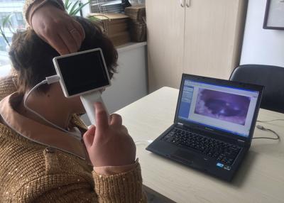Китай Опционный офтальмоскоп Otoscope Wifi модельный миниый с ультра - высоким разрешением продается