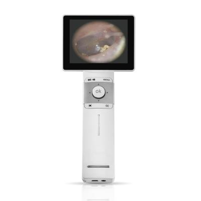 China Inspección completa de Digitaces del otoscopio video de Digitaces con el otoscopio de la salida de tarjeta del SD USB en venta