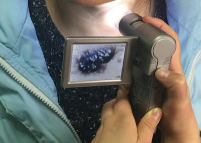 China Cámara video electrónica de Dermatoscope del dispositivo de la inspección de la piel y del pelo con la exhibición de color TFT de 3 pulgadas en venta