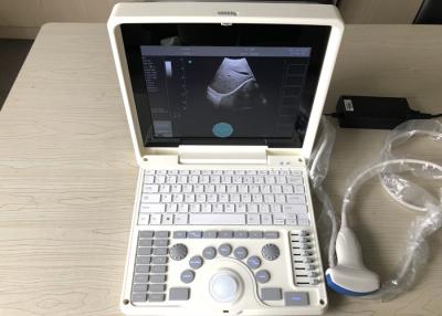 China Portable Pregnancy Ultrasound Scanner Intelligent Zoom 12 