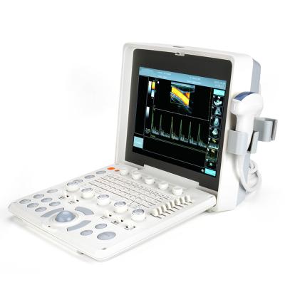 China 1024 Frame Laptop Color Doppler Device Portable Ultrasound Scanner With 2 Probe Connector for sale