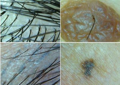 Chine Le microscope sans fil Digital Dermatoscope se relient à l'ordinateur pour l'inspection de peau et de cheveux à vendre