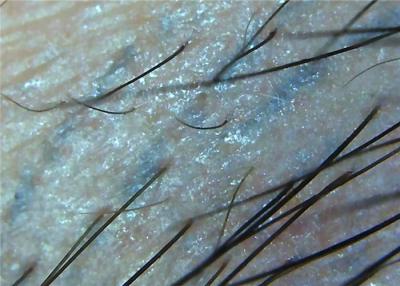 Chine microscope Digital Dermatoscope visuel de peau de la loupe 1000x pour le plein microscope d'inspection médicale à vendre