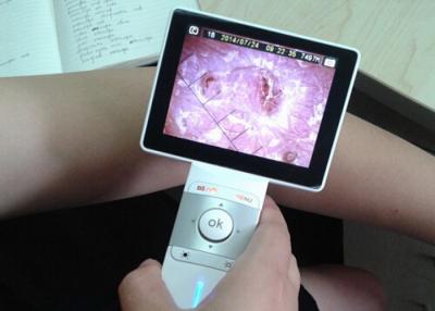 China Análise Handheld Dermatoscope video da pele e do cabelo com 3,5 polegadas LCD colorido à venda