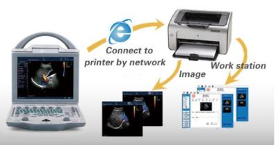 China 2.o dispositivo de diagnóstico ultrasónico del escáner de Digitaces del color de la máquina llena de Doppler en venta