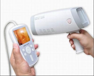 China Digital Handheld Cervical Camera Colposcope for Gynecology to Inspect Cervix with 80,0000 Pixels Resolution 1~128 Zoom for sale
