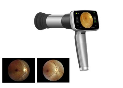 China Cámara video del fondo del PDA del oftalmoscopio 45° en venta