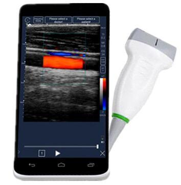 Chine Pleine radio portative mobile de machine d'ultrason de Digital avec l'écran tactile d'affichage à cristaux liquides de 6 pouces à vendre