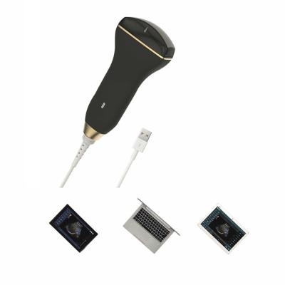 China Digital Smart Handheld Ultrasound Scanner Wireless Ultrasound Probe For Puncture Guidance for sale